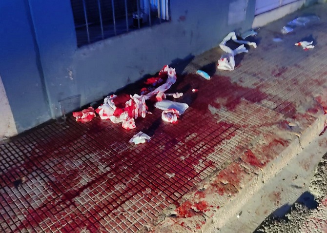 Uno de los heridos recibió una herida en la ingle y perdió abundante sangre tal y como se aprecia en la imagen.